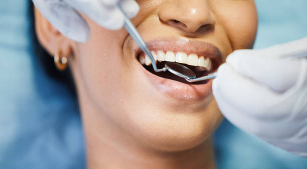 Best Chipped Tooth Repair Near Me  in Hawthorne, NJ